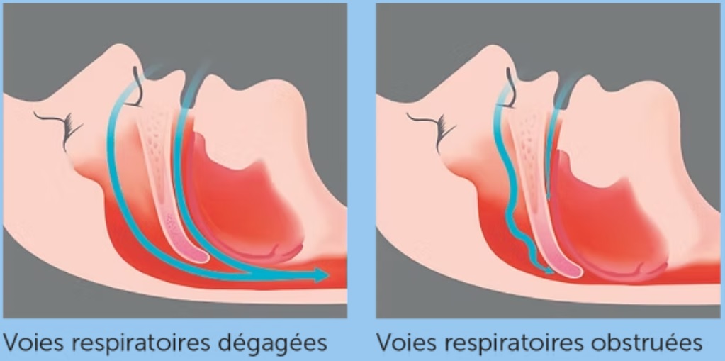 Voix respiratoires