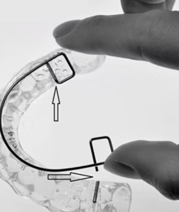 Utilisation Serenight